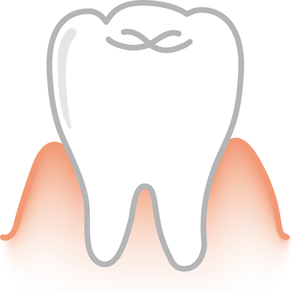 医療 歯（歯茎）（カラー）